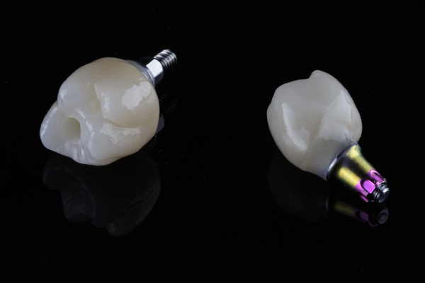 How Dental Implants Can Be Good For Your Jawbone