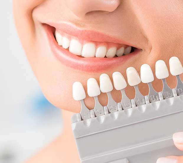 Needham Dental Veneers and Dental Laminates