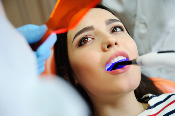 Smile Makeover: Choosing Between Dental Veneers And Crowns