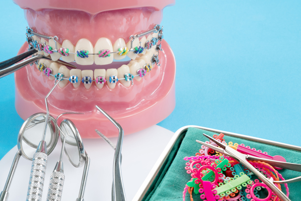 The Complete Guide To Teeth Straightening For Adults